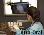 Intra-Oral Camera